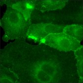 SKOV3 Cells GFP-HER2 RFP-EGFR