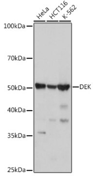 Anti-DEK Antibody, clone 2C2V8, Rabbit Monoclonal