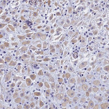 Anti-TRIM64 antibody produced in rabbit Prestige Antibodies&#174; Powered by Atlas Antibodies, affinity isolated antibody, buffered aqueous glycerol solution