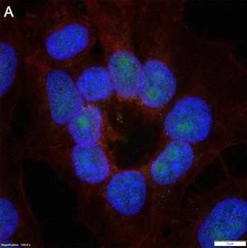 Anti-Phospho-IκBα-Ser32/36 Antibody, clone 1I11 ZooMAb&#174; Rabbit Monoclonal recombinant, expressed in HEK 293 cells