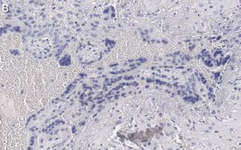 Anti-Angiopoietin-2 Antibody, clone 4L18 ZooMAb® Rabbit Monoclonal recombinant, expressed in HEK 293 cells