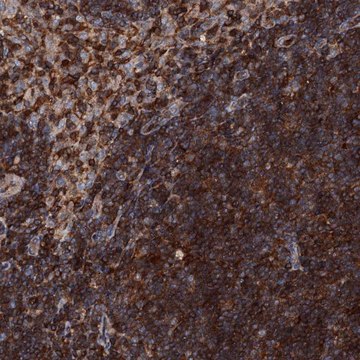 Anti-EDC4 antibody produced in rabbit Prestige Antibodies&#174; Powered by Atlas Antibodies, affinity isolated antibody, buffered aqueous glycerol solution