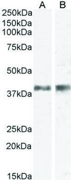 Anti-IL12B/IL12P40 (AB2) antibody produced in goat affinity isolated antibody, buffered aqueous solution