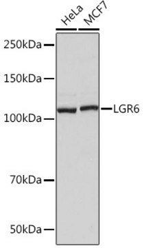 Anti-LGR6 Antibody, clone 8J2J10, Rabbit Monoclonal