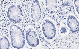 Anti-ZNF638 Antibody, clone 4C19 ZooMAb® Rabbit Monoclonal recombinant, expressed in HEK 293 cells