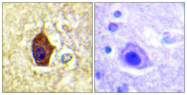 Anti-Synapsin1, antibody produced in rabbit affinity isolated antibody