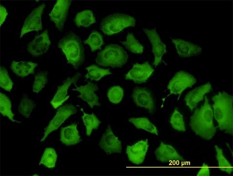 Monoclonal Anti-ANXA2, (C-terminal) antibody produced in mouse clone 1G7, purified immunoglobulin, buffered aqueous solution