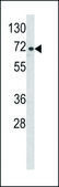ANTI-ARHGAP18 (CENTER) antibody produced in rabbit IgG fraction of antiserum, buffered aqueous solution