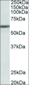 Anti-ZNF703 antibody produced in goat affinity isolated antibody, buffered aqueous solution