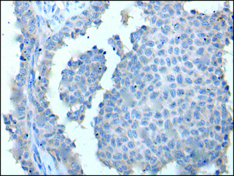 Anti-ZDHHC5 affinity isolated antibody