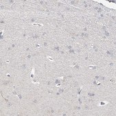 Anti-STAP1 antibody produced in rabbit Prestige Antibodies® Powered by Atlas Antibodies, affinity isolated antibody, buffered aqueous glycerol solution