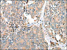 抗-EPHA2 affinity isolated antibody