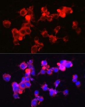 Anti-NPY5R Antibody, clone 8E4F9, Rabbit Monoclonal