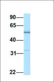 Anti-AHCYL1 (ab1) antibody produced in rabbit affinity isolated antibody