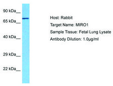 Anti-RHOT1 antibody produced in rabbit affinity isolated antibody