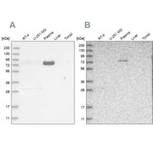 Anti-LRRC45 antibody produced in rabbit Prestige Antibodies® Powered by Atlas Antibodies, affinity isolated antibody, buffered aqueous glycerol solution
