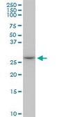 Monoclonal Anti-MAGEA12 antibody produced in mouse clone 3A10, purified immunoglobulin, buffered aqueous solution