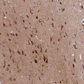 Anti-HDC antibody produced in rabbit Prestige Antibodies® Powered by Atlas Antibodies, affinity isolated antibody, buffered aqueous glycerol solution