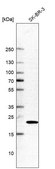 Anti-GGCT antibody produced in rabbit Prestige Antibodies® Powered by Atlas Antibodies, affinity isolated antibody, buffered aqueous glycerol solution