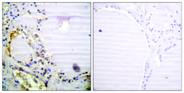 Anti-RBBP8 antibody produced in rabbit affinity isolated antibody