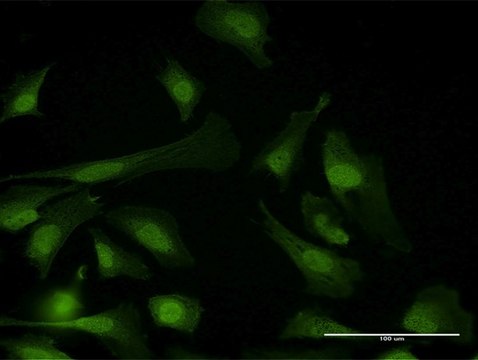 Anti-PPP6C antibody produced in mouse purified immunoglobulin, buffered aqueous solution