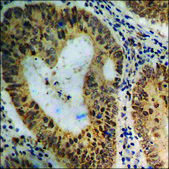 Anti-phospho-BRCA1 (pSer1423) antibody produced in rabbit affinity isolated antibody
