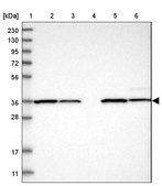 Anti-ZBTB37 antibody produced in rabbit Prestige Antibodies® Powered by Atlas Antibodies, affinity isolated antibody, buffered aqueous glycerol solution