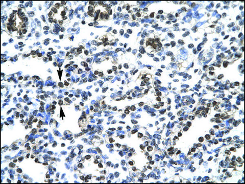 Anti-CIC IgG fraction of antiserum