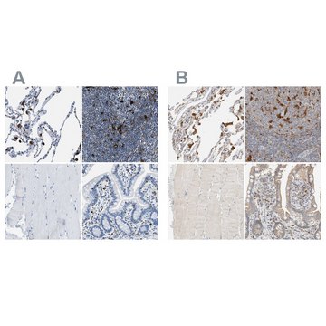 Anti-CAPG antibody produced in rabbit Prestige Antibodies&#174; Powered by Atlas Antibodies, affinity isolated antibody, buffered aqueous glycerol solution