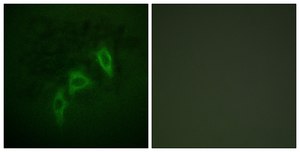 Anti-TSC2 antibody produced in rabbit affinity isolated antibody