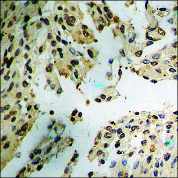 Anti-phospho-p56 Dok-2 (pTyr299) antibody produced in rabbit affinity isolated antibody