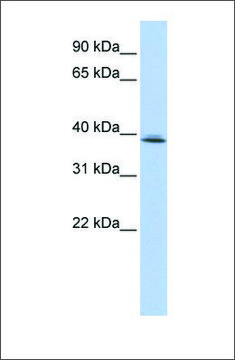 Anti-SRRD antibody produced in rabbit affinity isolated antibody