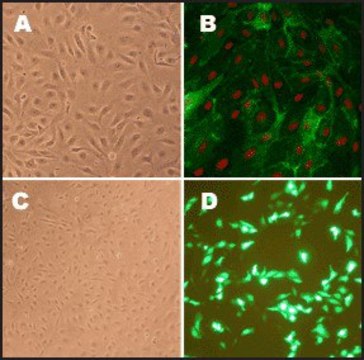 Human Pulmonary Artery Endothelial Cells: HPAEC, adult