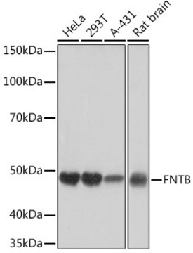 Anti-FNTB Antibody, clone 3I4X5, Rabbit Monoclonal