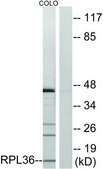 Anti-RPL36 antibody produced in rabbit affinity isolated antibody