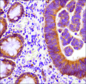 Anti-Thymidylate Synthase antibody, Rabbit monoclonal clone SP112, recombinant, expressed in proprietary host, affinity isolated antibody