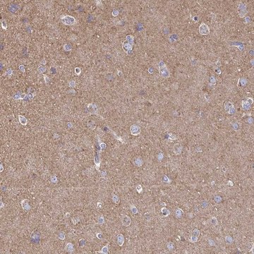 Anti-CLTC antibody produced in rabbit Prestige Antibodies&#174; Powered by Atlas Antibodies, affinity isolated antibody, buffered aqueous glycerol solution