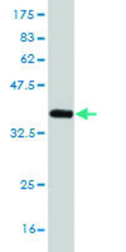 Monoclonal Anti-NEFH antibody produced in mouse clone 2E8, purified immunoglobulin, buffered aqueous solution