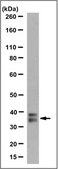 Anti-Homeobox protein CDX-2 Antibody, clone 7D9.1 clone 7D9.1, from mouse
