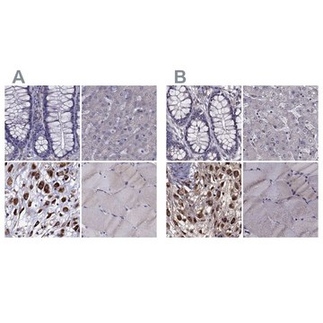 Anti-IKBIP antibody produced in rabbit affinity isolated antibody