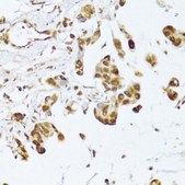 Anti-IRF3 antibody produced in rabbit