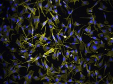 YUMM2.2 Mouse Melanoma Cell Line