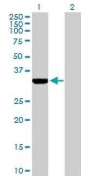 Anti-ECH1 antibody produced in rabbit purified immunoglobulin, buffered aqueous solution