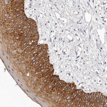 Anti-STK16 antibody produced in rabbit Prestige Antibodies&#174; Powered by Atlas Antibodies, affinity isolated antibody, buffered aqueous glycerol solution