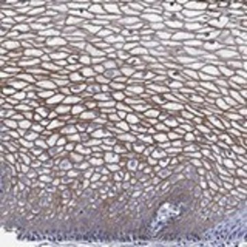 Anti-TMPRSS11D antibody produced in rabbit Prestige Antibodies® Powered by Atlas Antibodies, affinity isolated antibody, buffered aqueous glycerol solution