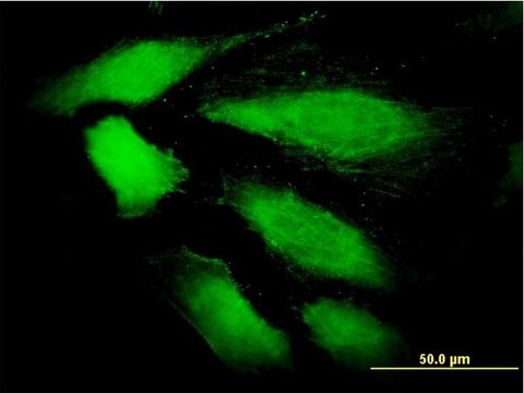 Monoclonal Anti-DDEF1 antibody produced in mouse clone 2G7, purified immunoglobulin, buffered aqueous solution