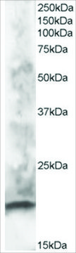 Anti-CABP1 antibody produced in goat affinity isolated antibody, buffered aqueous solution