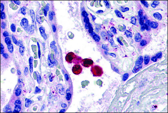 Anti-TLR4 antibody produced in rabbit affinity isolated antibody