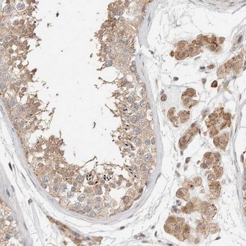 Anti-KIF9 antibody produced in rabbit Prestige Antibodies&#174; Powered by Atlas Antibodies, affinity isolated antibody, buffered aqueous glycerol solution, Ab2