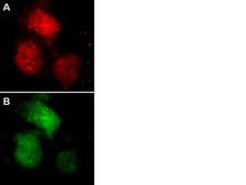 LentiBrite RFP-Rad51 Lentiviral Biosensor
